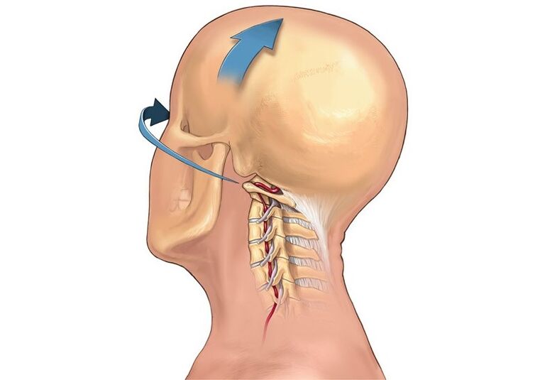 krčenie krku pri otáčaní hlavy ako príznak cervikálnej osteochondrózy