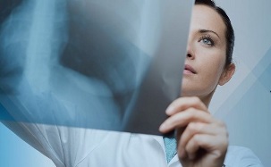 diagnostika cervikálnej osteochondrózy