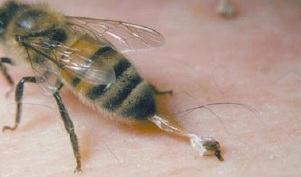 liečba artrózy bedrového kĺbu včelami