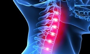 prejavy osteochondrózy krčnej chrbtice